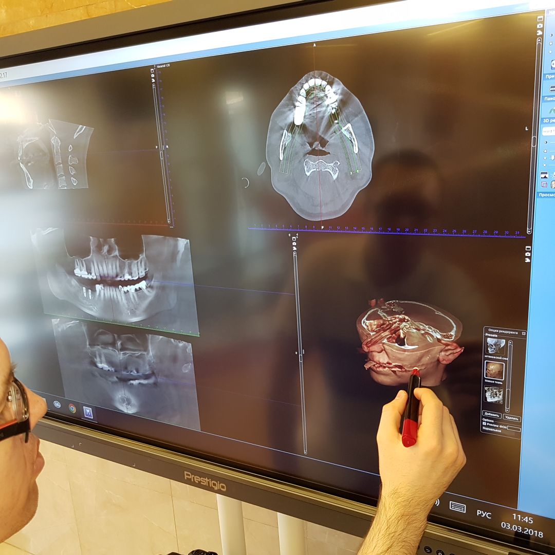 Бесплатная цифровая диагности All on 4 цифровая диагностика all on 4 бесплатно